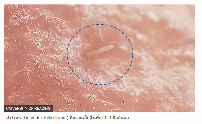 ตัวไรขนที่ผสมพันธุ์บนหน้าคนตอนกลางคืน เผชิญวิกฤตทางพันธุกรรมจนเสี่ยงใกล้สูญพันธุ์